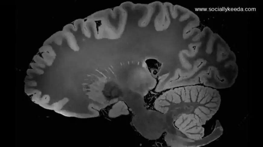 Brain Activity Of 87-Year-Old Dying Man Reveals That The Entire Life History Flashes Before Our Eyes In Final Moments; Watch Video